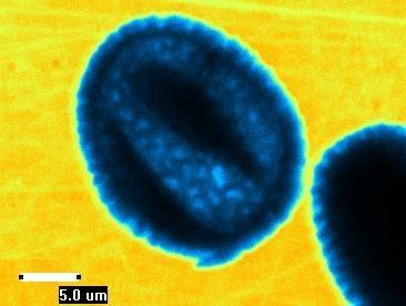 Rivelatori di radiazione luminescenti a film sottile di fluoruro di litio